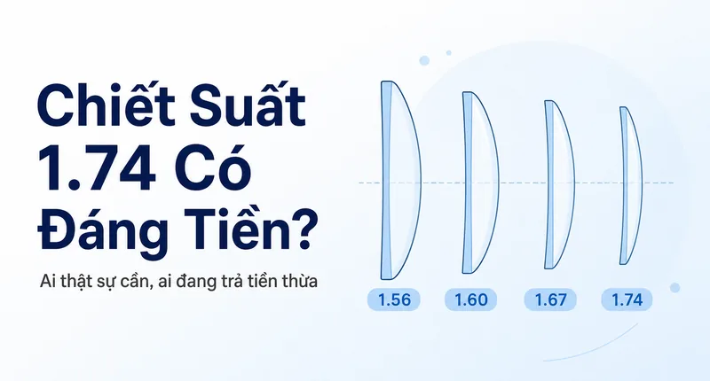 Chiết Suất 1.74 Có Đáng Tiền Không? Phân Tích Thẳng Trước Khi Bạn Trả Thêm